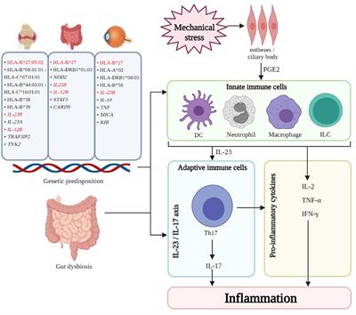 Managing Psoriatic Arthritis With Inflammatory Bowel Disease and/or Uveitis